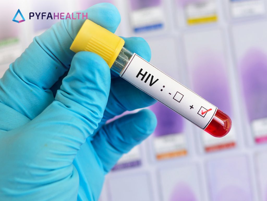 Cara Penularan HIV AIDS Pengobatan Dan Pencegahannya