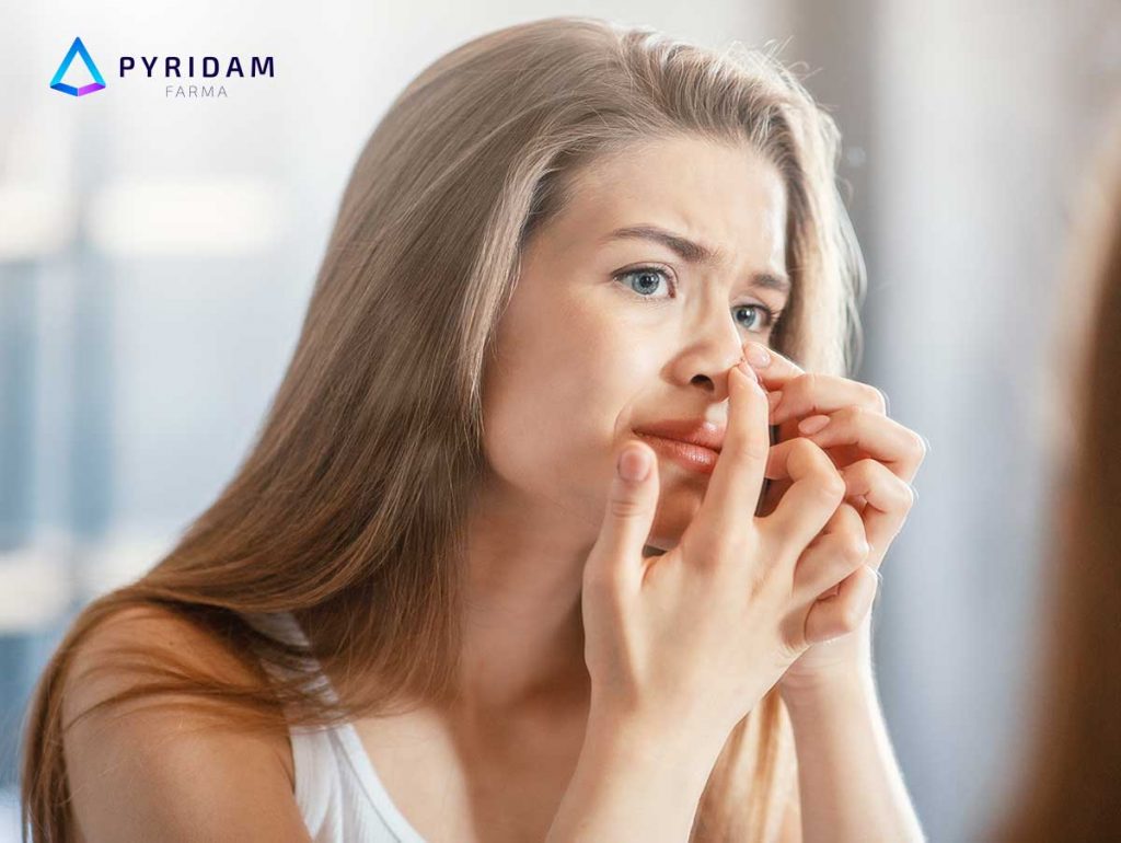 6 Cara Menghilangkan Komedo Secara Alami