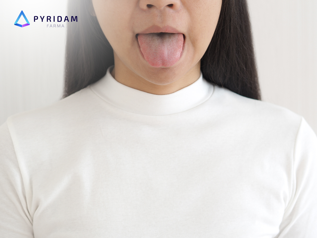 Apa penyebab dan gejala kanker mulut, serta bisakah penyakit ini dicegah? Berikut penjelasannya.