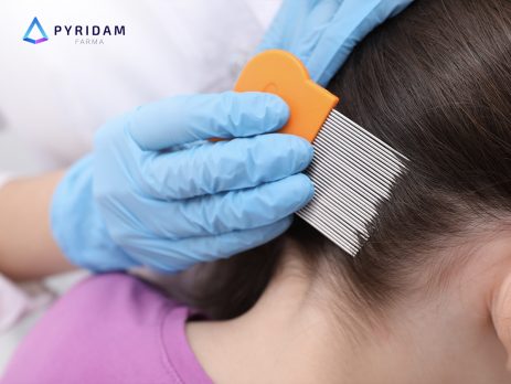 cara menghilangkan kutu rambut