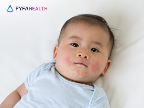 bintik merah pada bayi
