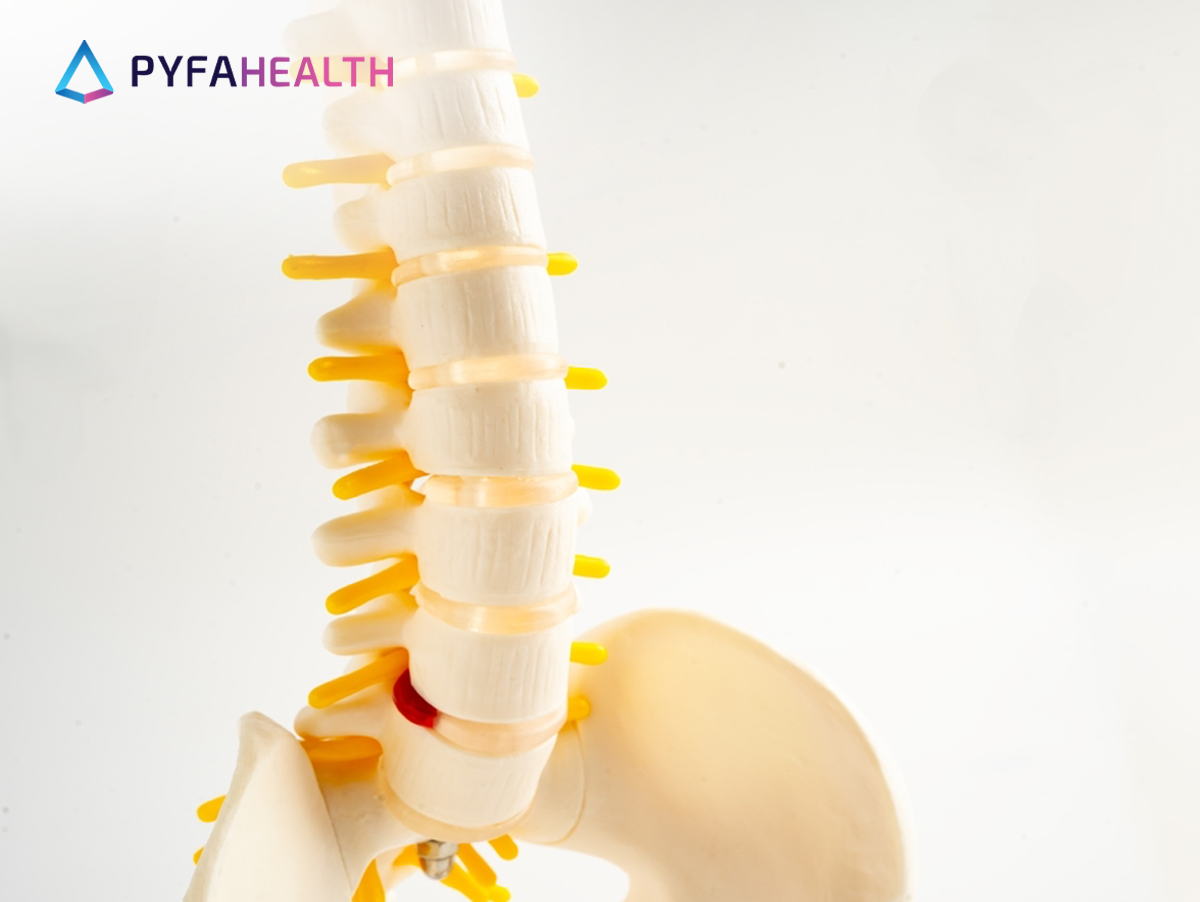 Apa Itu Osteoporosis_ Kenali Penyebab dan Gejala yang Menyertainya