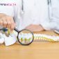 Osteoporosis Disebabkan oleh Apa? Inilah Penyebab dan Cara Mencegahnya