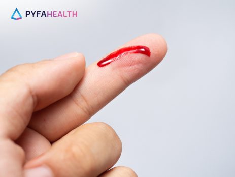 Tangan Luka Kena Pisau Silet- Pertolongan Pertama dan Cara Mengobatinya