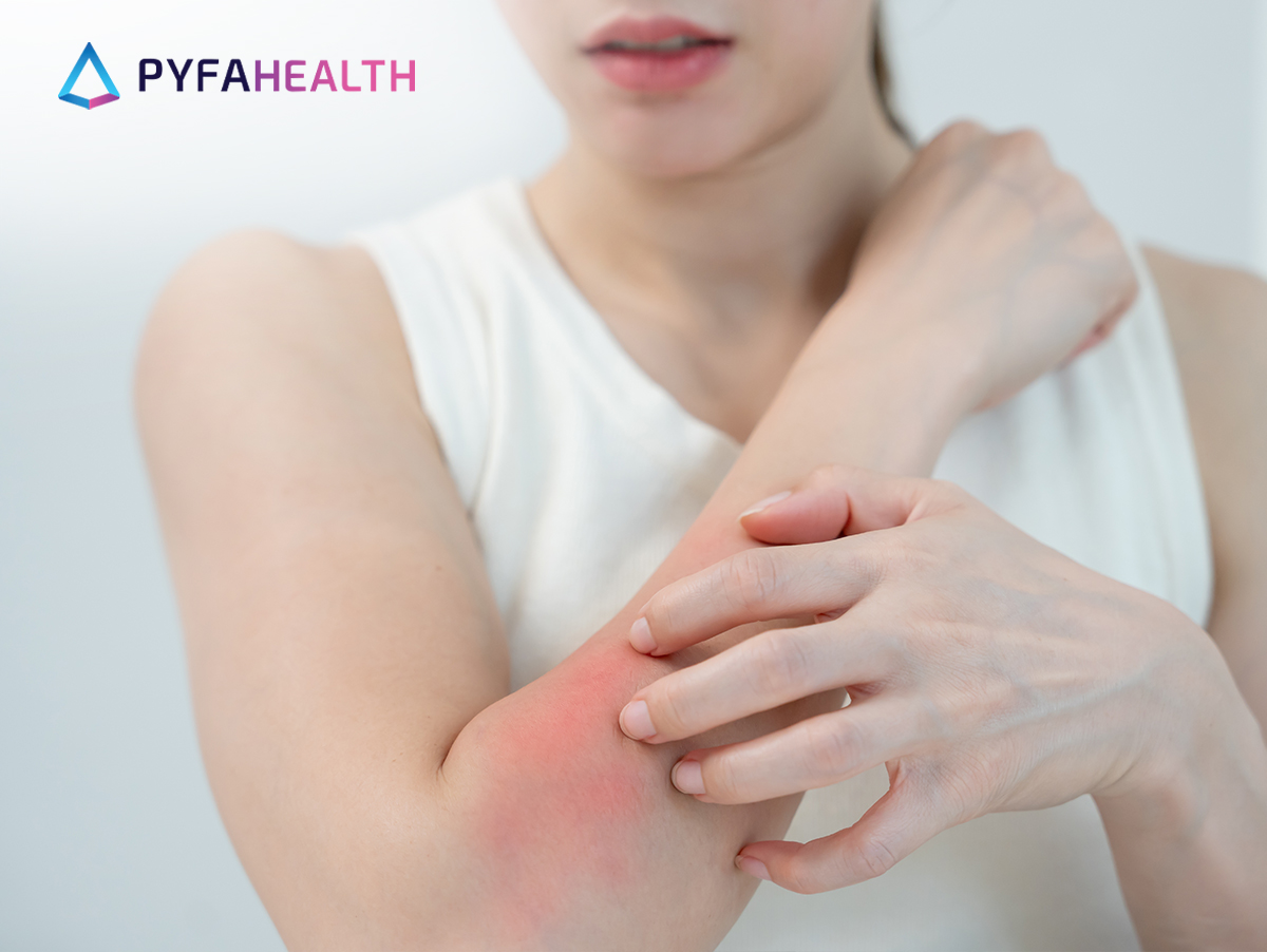 cara menghilangkan gatal secara alami dan cepat.docx