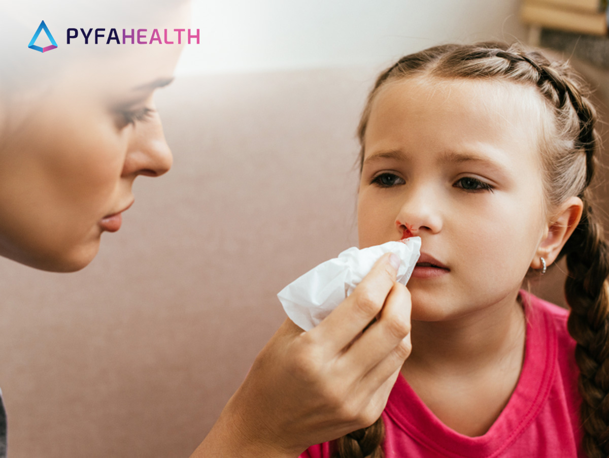 penyebab mimisan pada anak