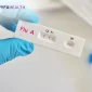 virus influenza tipe a