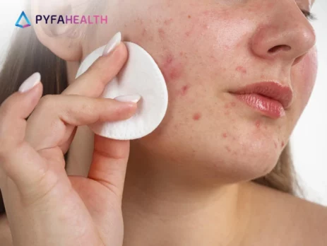 Skincare untuk Kulit Berminyak